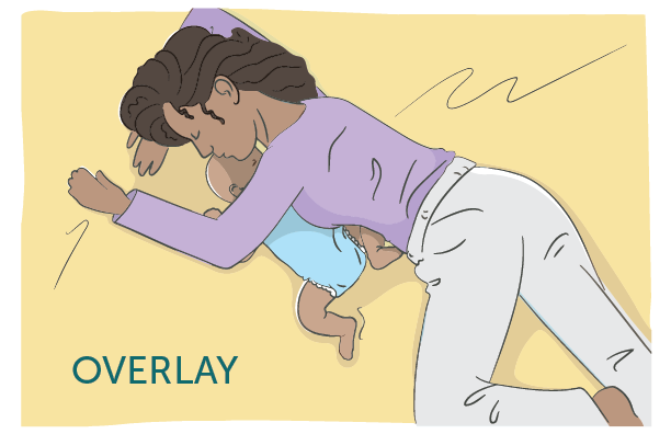 An illustration of overlay: When another person shares the sleep surface with the infant and lays on or rolls on top of or against the infant while sleeping, blocking the infant's airway.